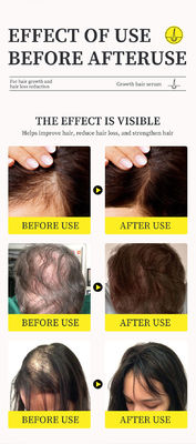 Un sérum puissant contre la perte de cheveux avec de l' huile de gingembre et de la vitamine B5